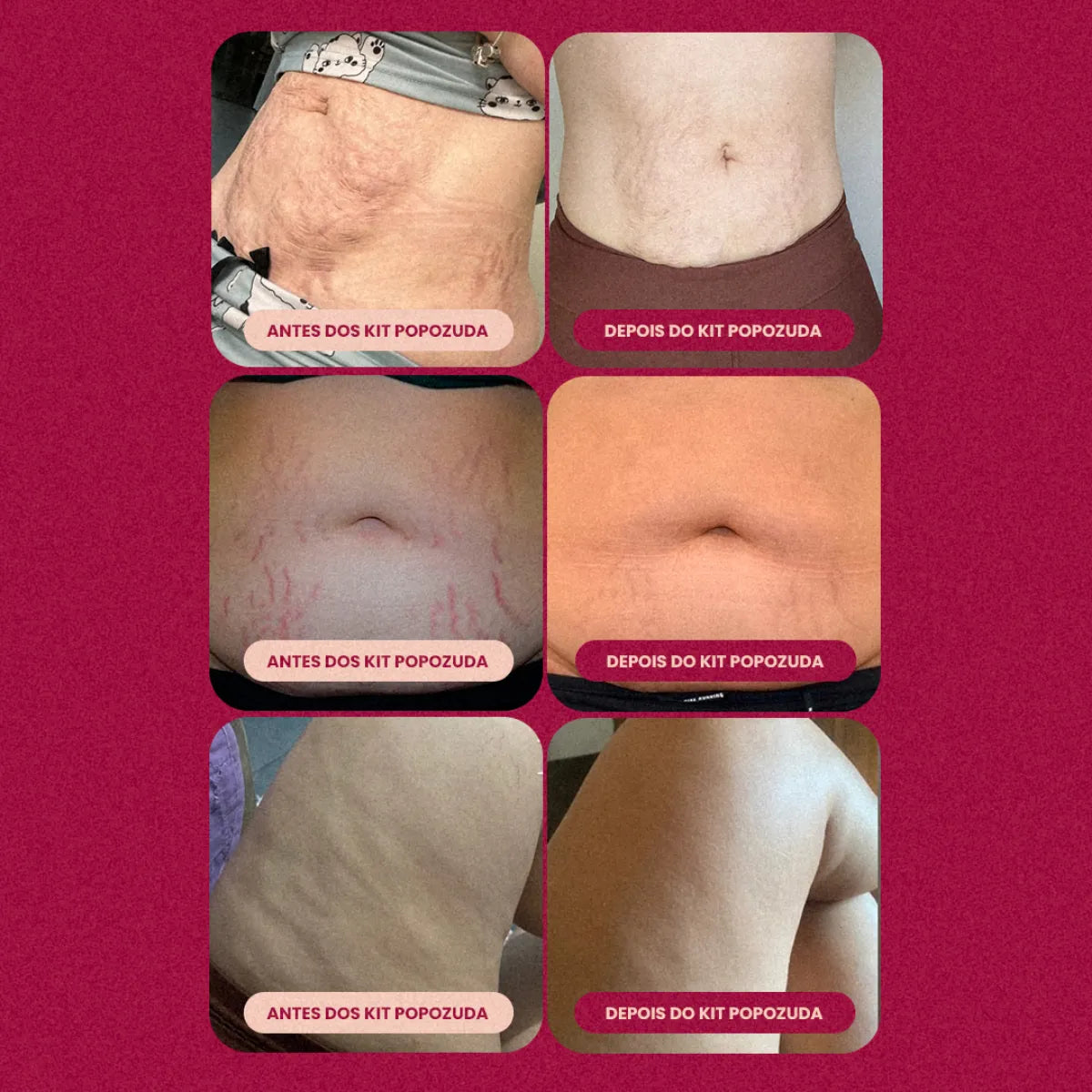 [COMPE 1 LEVE 2] Popozuda Creme Para Lipedema Celulite E Estrias 200g – imagem 3